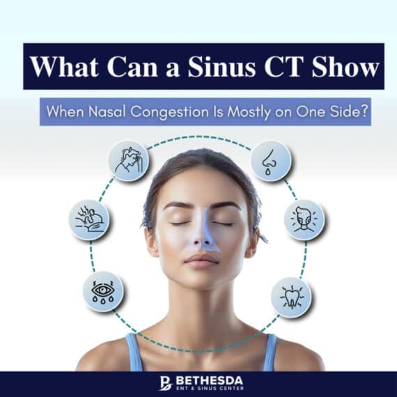 Sinus CT Scan